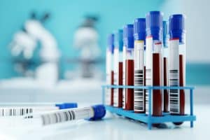 Can You Challenge Blood Test Results for DUI?